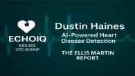 AI Heart Tech Breakthrough - Ellis Martin Interviews Dustin Haines, CEO Echo IQ Limited (ASX:EIQ)