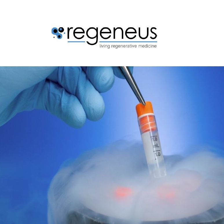 Regeneus and Kyocera Sign Progenza OA Deal